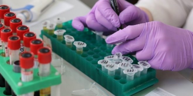 اهتم بصحتك لا تهملها .. التحاليل والفحوصات الطبية تحميك من الأمراض