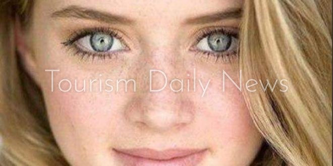 النمش .. أنواعه وأسبابه وطرق علاجه