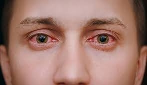 فيروس كورونا يتطور بشكل مخيف