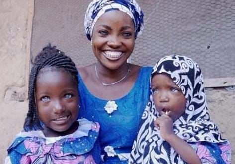 هجرها زوجها خوفاً من عيونها الزرقاء .. ريسيكات تعانى من العنصرية