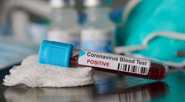 بولندا تسجل 548 وفاة جديدة بفيروس كورونا وأعداد الضحايا تتجاوز 10 آلاف