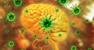 تحذيرات للعاملين بمحطات مصر للطيران .. نيباه فيروس جديد ليس له علاج