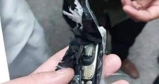 ثاني حالة نادرة استخراج موبايل من بطن شاب بمستشفى بنها الجامعي بالقليوبية