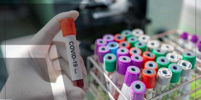 ارتفاع وتيرة حالات الإصابة بفيروس كورونا .. الصين تسجل 18 ألف حالة في يوم