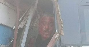 مشهد مأساوي في حادث تصادم أتوبيس بسيارة نقل على طريق المحمودية جمصة