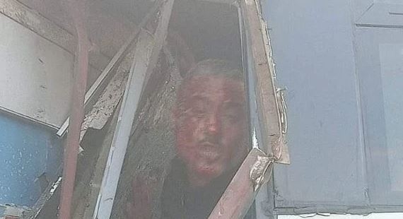 مشهد مأساوي في حادث تصادم أتوبيس بسيارة نقل على طريق المحمودية جمصة