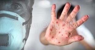 تركيا تنفي اكتشاف إصابة لاجئ سوري بمرض جدري القرود في منطقة إسنيورت