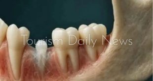 اليابان تبدأ أول تجربه بشريه لدواء يعيد نمو الأسنان